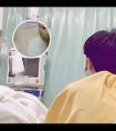 308激光治疗时可涂外用药吗视频